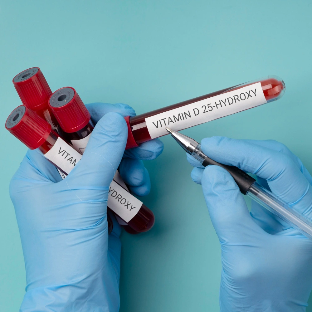 VITAMIN D 25-HYDROXY