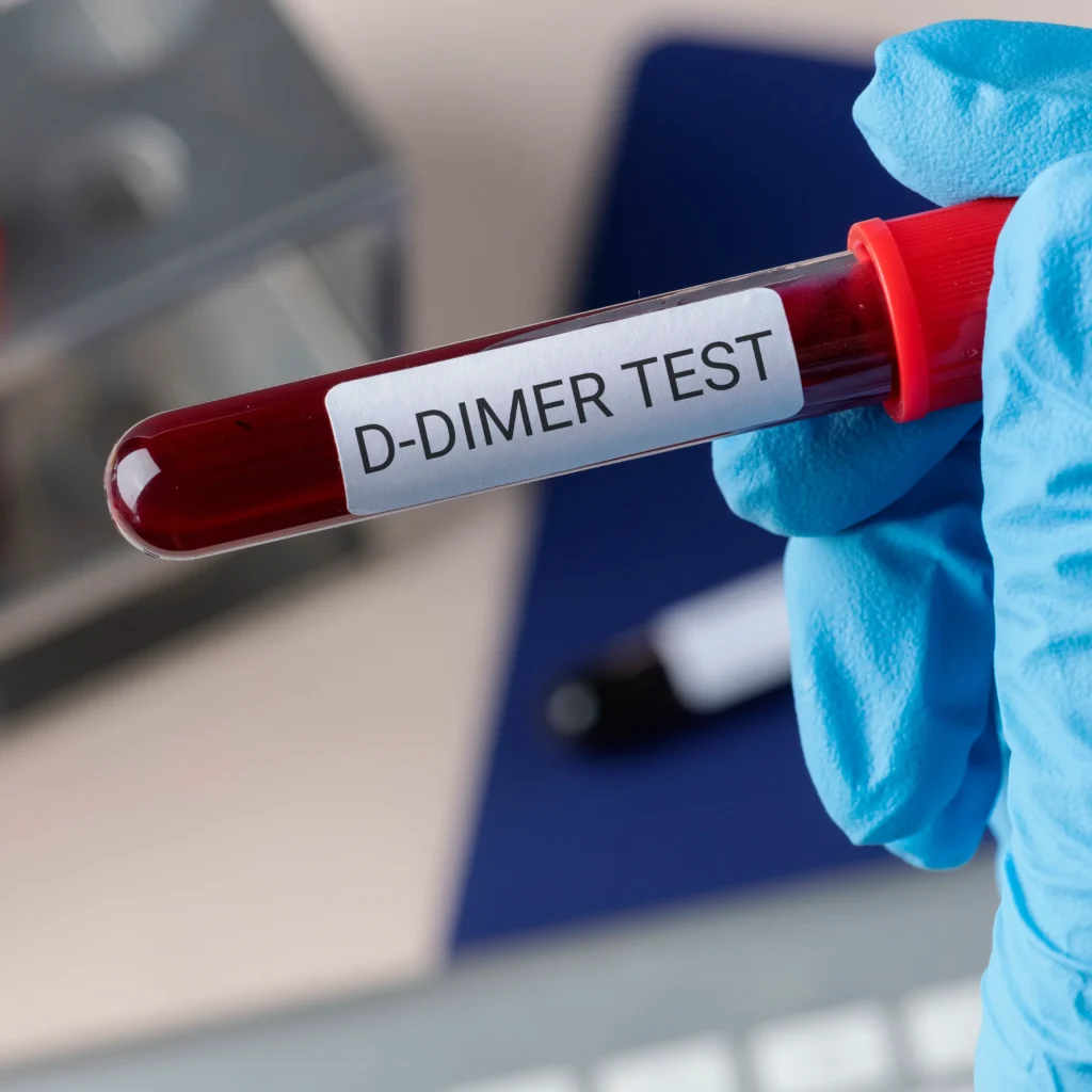 D Dimer Lab D-Dimer Test - LifeBlood