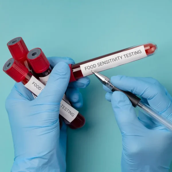foodANALYZER IgG Food Sensitivity Testing - LifeBlood